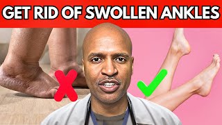 WATCH This BEFORE You Take A WATER PILL