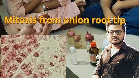 Mitosis cell division from onion root tip|| Biology practical| B.Sc Honours