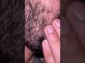 #salon #barber #asmr#ingrownhairremoval #removeingrown #satisfying #oddlysatisfying #blackheads