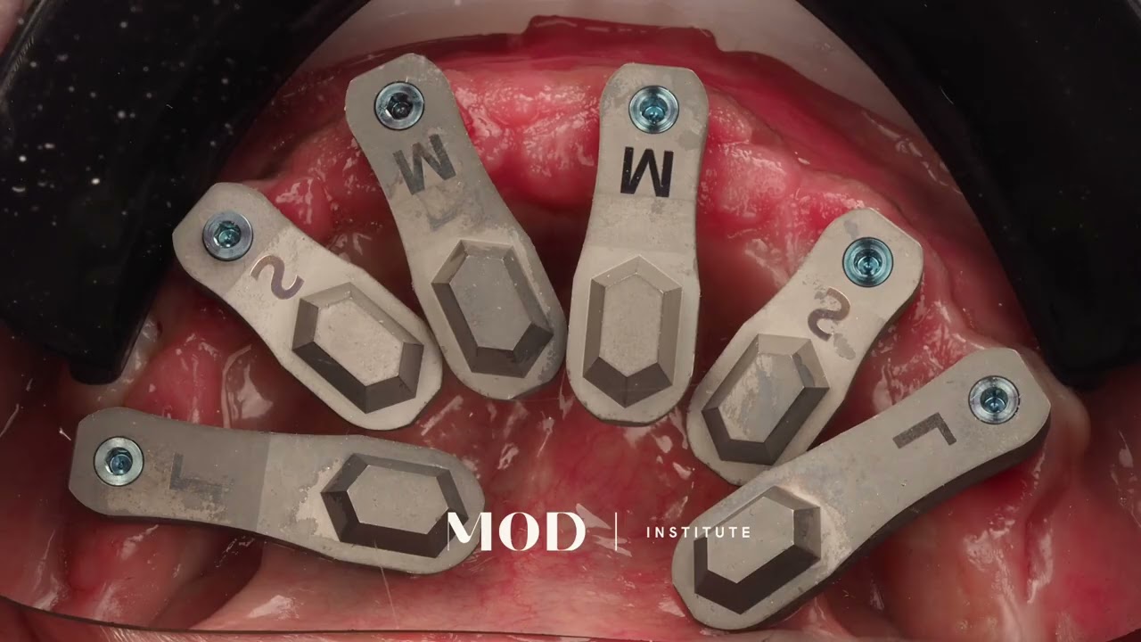 All on X scanning Tutorial