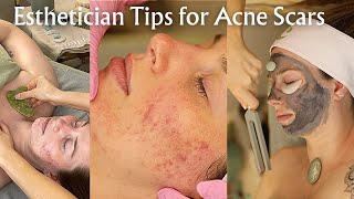 asmr professional acne facial for scars with sound healing therapy part 1