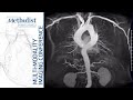 Diseases of the Aorta: A Multi-Modality Approach (Quiñones, MD and Chamsi-Pasha, MD) March 9, 2021