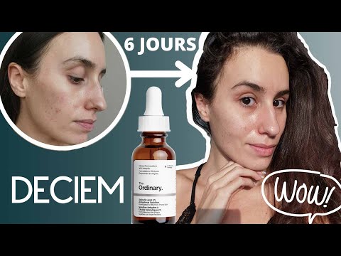 Vidéo: Quand utiliser le sérum d'acide salicylique ?