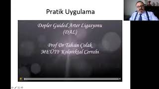 Hemoroidal Hastalığın Cerrahi Tedavisinde Güncel Gelişmeler Kısım - 2 Prof. Dr. Tahsin Çolak 2