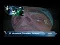 Jaipurdoorbeen hospital live stream