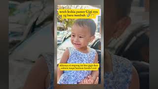 Leshia shows off her new teeth #lestikejora #rizkybillar #shorts #viralvideo #video #fyp