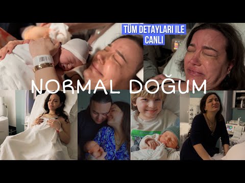 Canlı doğum anı | Bastan sona normal doğum anı | epidural normal doğum | doğum vlog | yurtdışı doğum