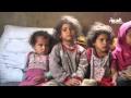 تقرير اليونيسيف يدعو لوقف معاناة الأطفال في اليمن