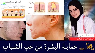 حماية البشرة من حب الشباب | الدكتورة أسما شنبور