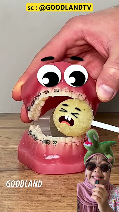 Download lagu Uncle's little brother's tooth wants to go into his mouth #short GOODLANDTV
