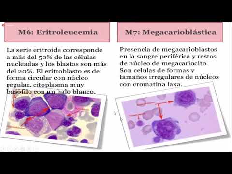 Vídeo: La Inferencia De Sistemas Epigenómica De La Actividad Del Factor De Transcripción Implica La Inactivación Del Receptor De Hidrocarburos De Arilo Como Un Evento Clave En El Desarrol