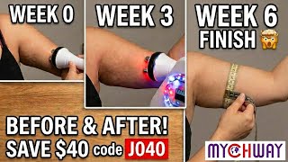 I Spent 6 Weeks Testing Cavitation on my Bingo Wings - Here's Real Results 🤯