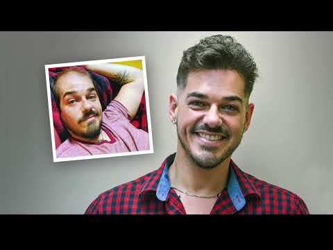 Elliott's Hair Replacement Makeover - Confidence Restored