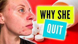 Spironolactone for Hormonal Acne | Before You Start Watch This