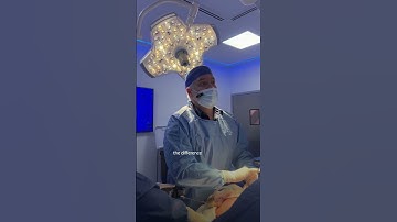 Robotic surgery vs laparoscopic surgery? PART 1