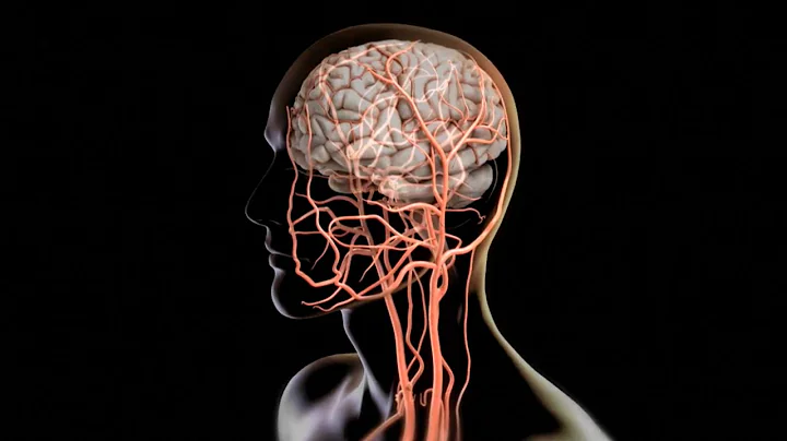 How to pull a clot from the brain | Science News