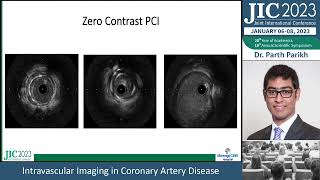 JIC 2023 | DAY-2 : CARDIOVASCULAR SYMPOSIUM