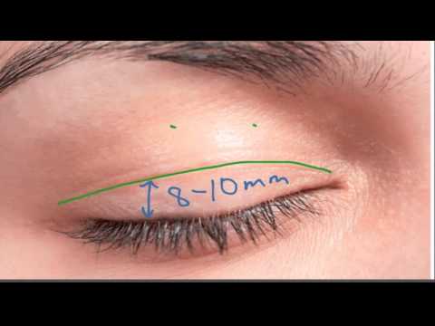 וִידֵאוֹ: המיתוסים העיקריים על Blepharoplasty