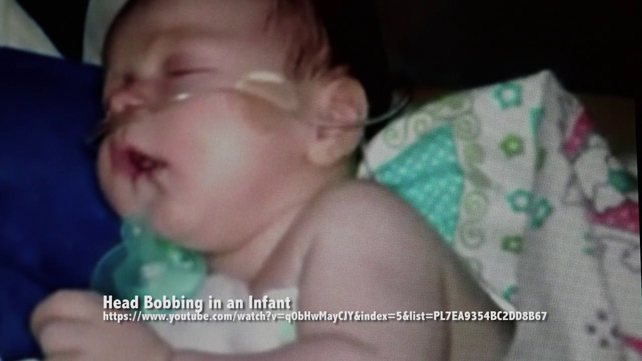 3 7 Signs Of Respiratory Distress In Children YouTube 3-7-signs-of-respiratory-distress-in-children-youtube