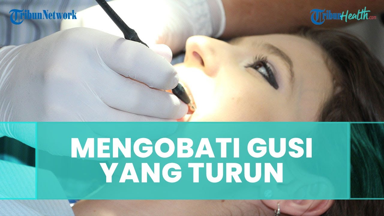 Cara Mengobati dan Mencegah Gusi yang Turun 