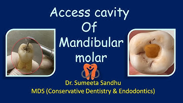 Access cavity of Mandibular Molar| Lower molar access opening
