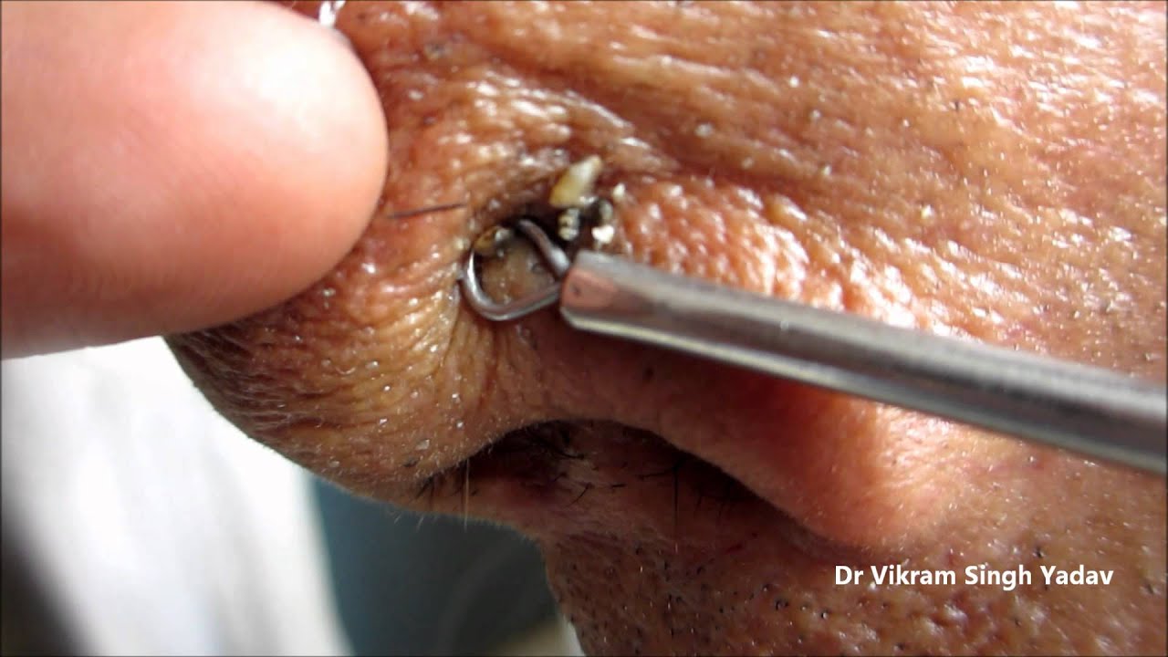 Video Thumbnail: Dr VikRam's Best Video No 2 — High-Entropy Discovery