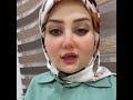 قلب الشفة جراحيا قلب الشفة جراحيا