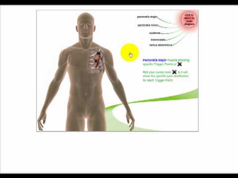 free myofascial trigger point charts youtube myofascial trigger point charts