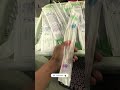 Wait for end #hemodialysis #patient #dialysis #patientcare #viralvideo #foryou #1million #views