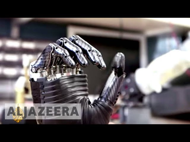 Bionic arm: A pioneering union between man and machine - The Cure