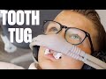 PULLING TEETH OUT WITH PLIERS | INTENSE TOOTH EXTRACTION FOR BRACES