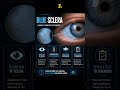 Sclera diseases | #optometry #sclera #eyes #body #ophthalmology #medical