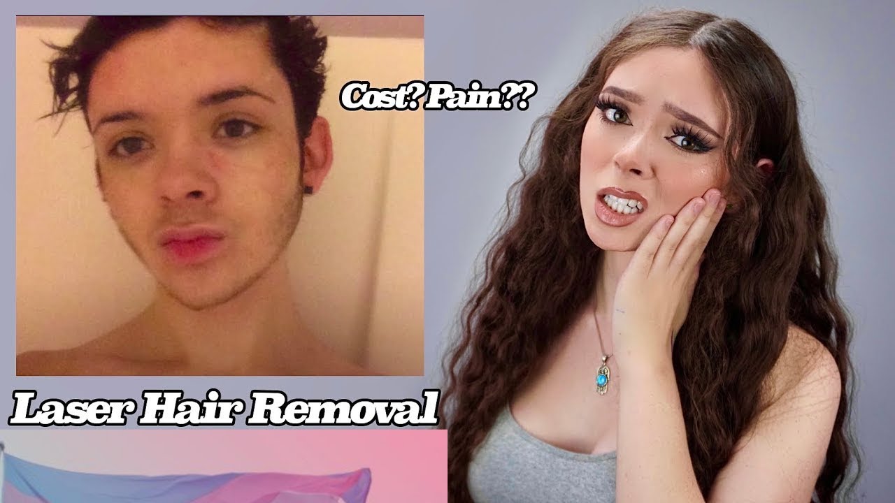 MTF Laser Hair Removal [Laser Hair Removal Information For Male to