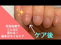 【セルフネイル】甘皮処理✨ネイルケア