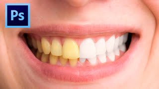 เทคนิคเปลี่ยนฟันเหลืองเป็นฟันขาวแบบง่ายและเร็ว