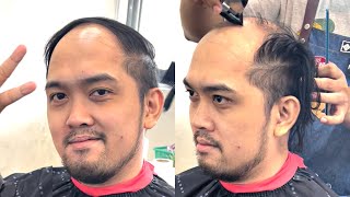 Saying Goodbye To My Combover