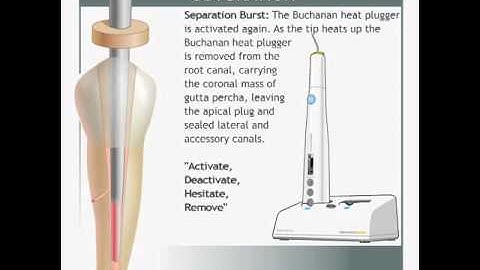 elementsfree Obturation System