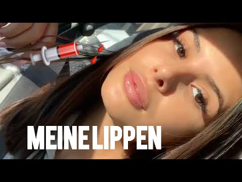 Video: Welche Berühmtheit Hat Gepumpte Lippen