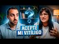 Escondí mis manchas a mi FAMILIA durante años | Mi historia con el vitíligo (Gabi)