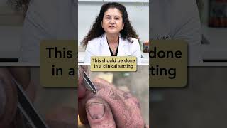 The Biggest Splinter Weve Ever Seen