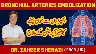 Successful Bronchial Arteries Embolization | Dr Zaheer Sherazi - Interventional Radiologist