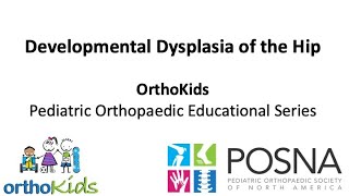 Developmental Dysplasia of the Hip (DDH)