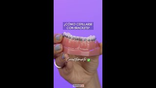 ¿Cómo cepillarte con brackets?   Odontología Láser #Shorts