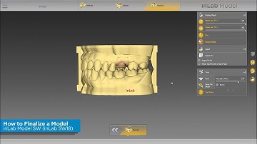 inLab Model SW: How to Finalize a Model