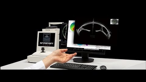 ANTERION Heidelberg Engineering