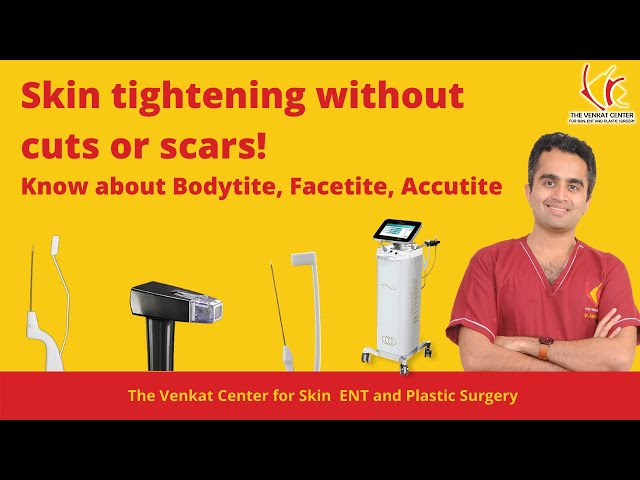 Skin tightening without any operation or scars | Latest Technology bodytite Explained by Doctor