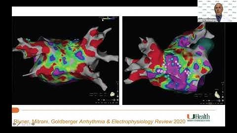 Is afib considered heart disease for life insurance