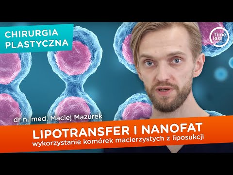 #Lipotransfer i #nanofat - wykorzystanie komórek macierzystych z liposukcji