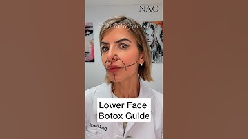 Lower Face Botox  #lowerfacebotox #botoxdosing #botoxtraining #drbitafarrell