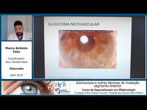 Gonioscopia e outras técnicas de Avaliação do Segmento Anterior_Marco Antonio Felix_Glaucoma